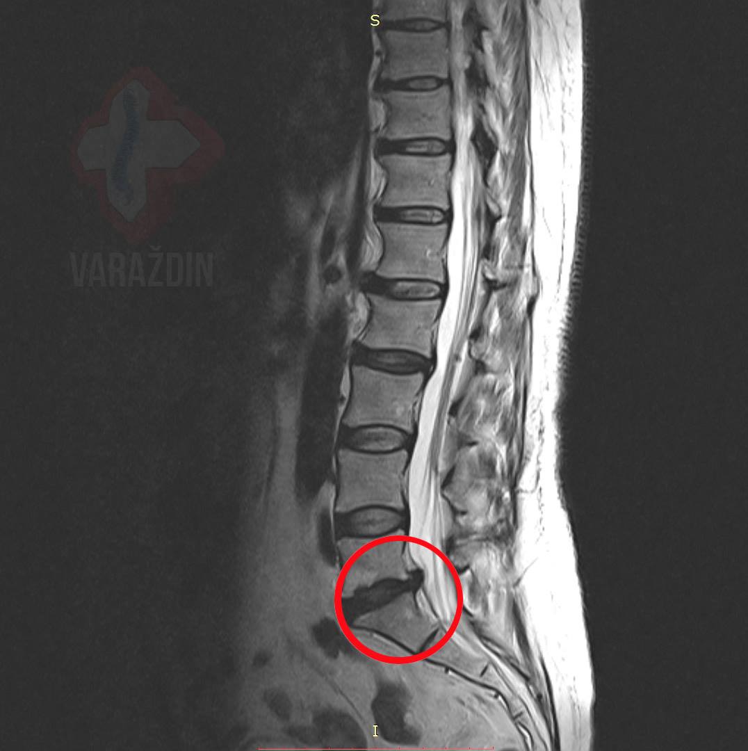 06e3fd30da2c8dfe043a6546f4f4f1f8.jpg?v=2