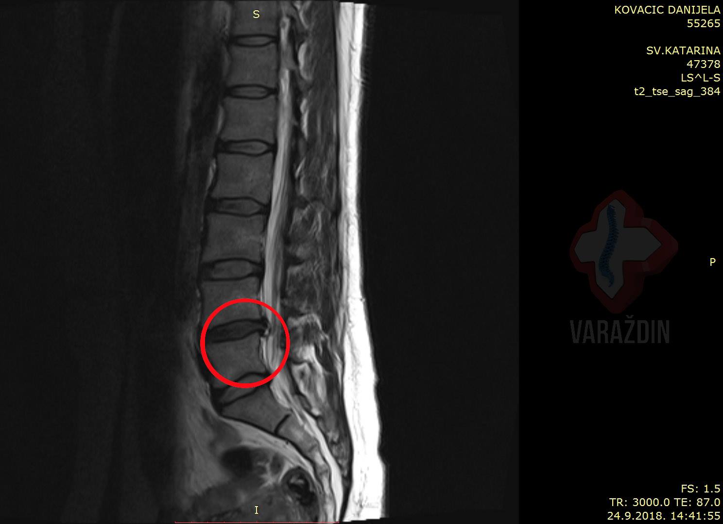 651a1e76bef870a836bc568aeb6d6231.jpg?v=2