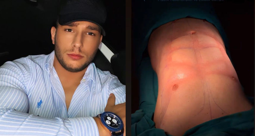 Ono što drugi skrivaju, on javno dijeli: Domaći influencer otišao na liposukciju vrijednu 12 tisuća eura