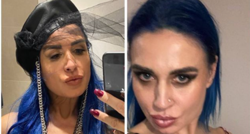 FOTO PRIJE I POSLIJE! Vampirica Olja povećala grudi sa 2C na 7C: 'Predivno ti stoje!'