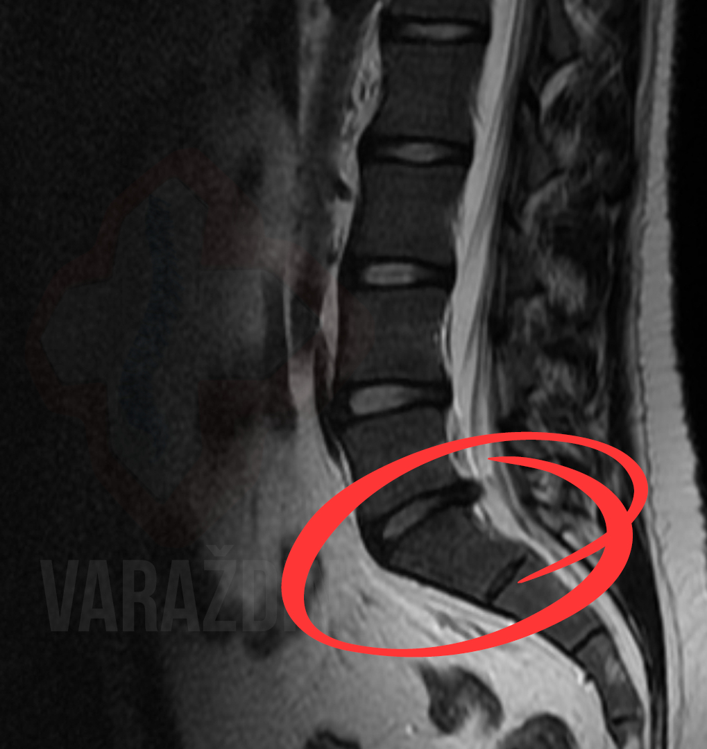 b28cfa1f37f0202876abd38a97ff0d59.jpg?v=2