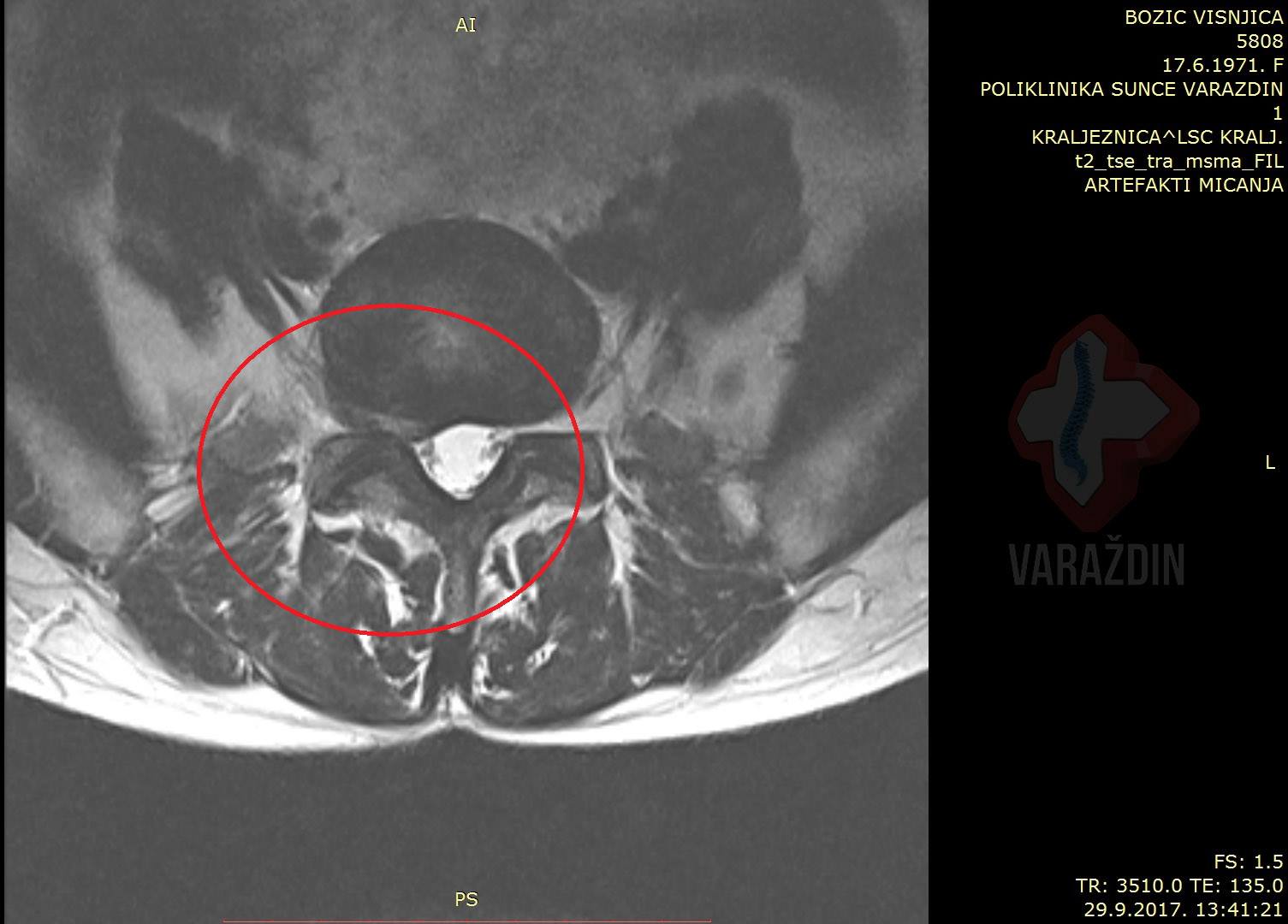 d27c75e44c86d43d5268fd5ffb8f13f0.jpg?v=2